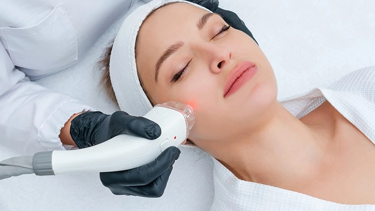 Q-Switched Laser (Tan & Pigmentation Removal)