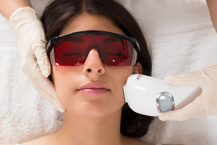 Sidelocks Laser Hair Reduction