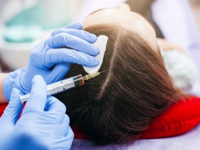 QR678 Hair Regrowth Therapy (Revital Trichology)