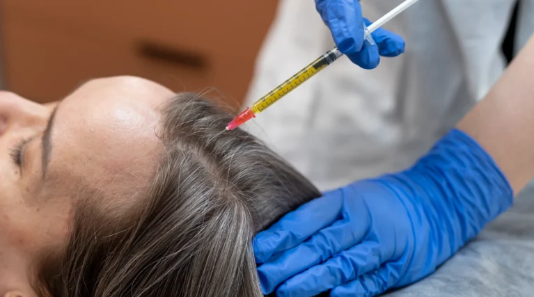 high-angle-patient-getting-prp-injection-alopecia (1) (1)